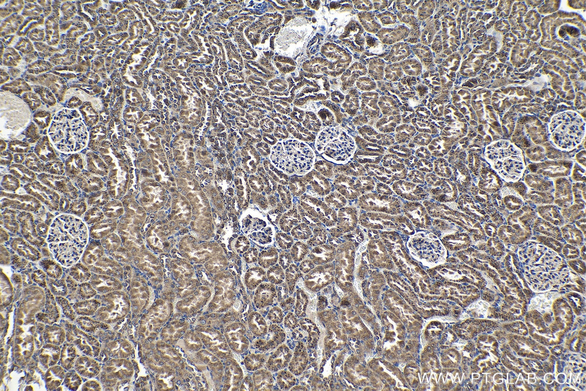 Immunohistochemical analysis of paraffin-embedded rat kidney tissue slide using KHC1361 (IGF2R-Specific IHC Kit).