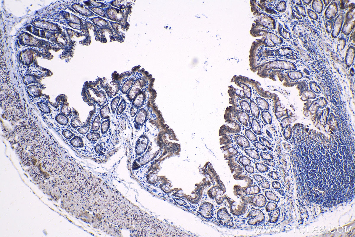 Immunohistochemical analysis of paraffin-embedded mouse colon tissue slide using KHC1333 (IGFBP2 IHC Kit).