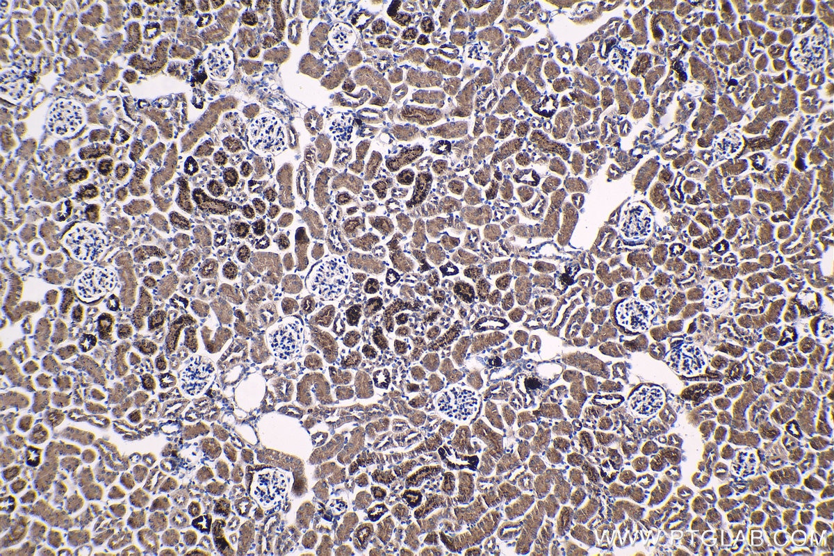 Immunohistochemical analysis of paraffin-embedded mouse kidney tissue slide using KHC1333 (IGFBP2 IHC Kit).