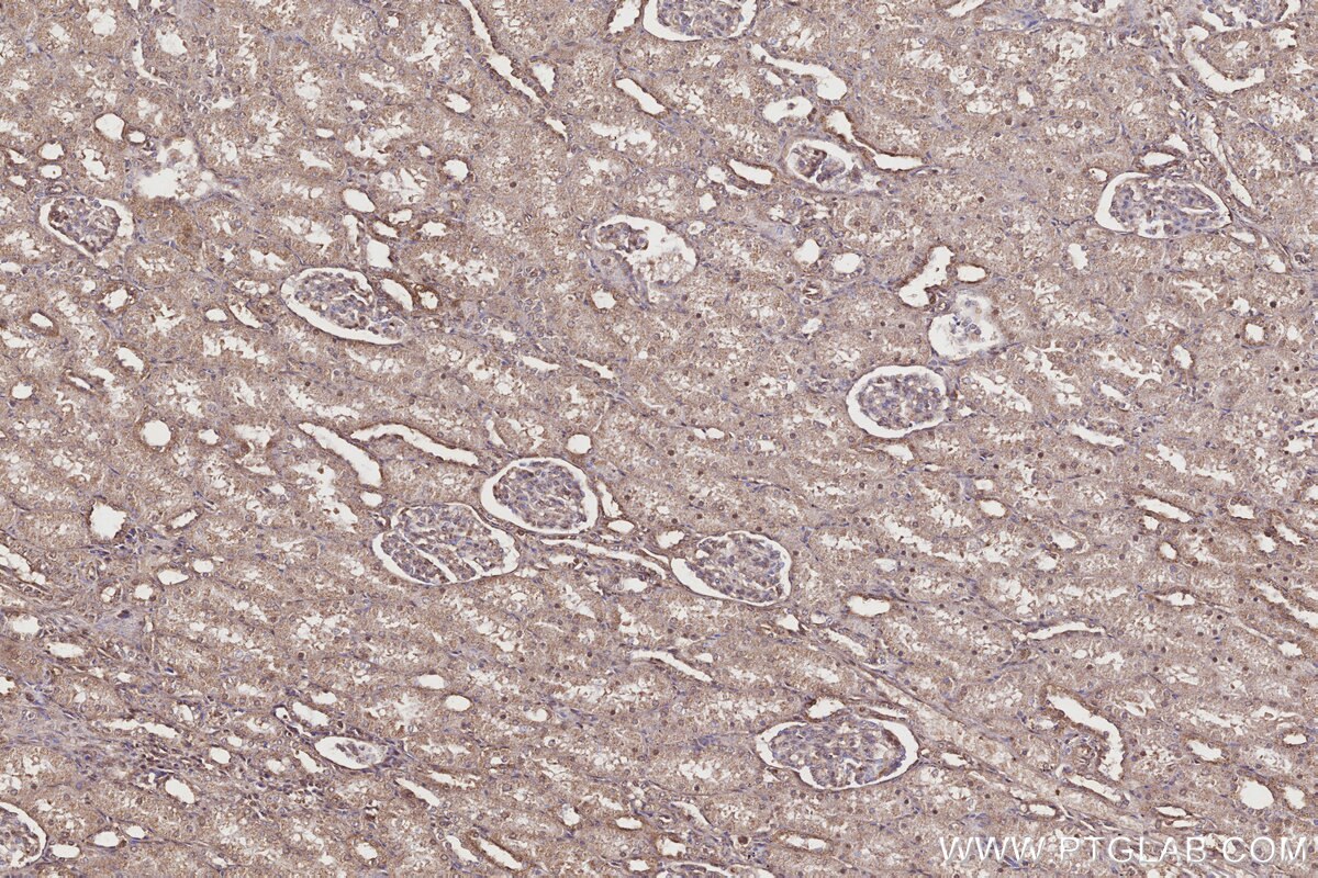 Immunohistochemical analysis of paraffin-embedded human kidney tissue slide using KHC3201 (IGFBP5 IHC Kit).