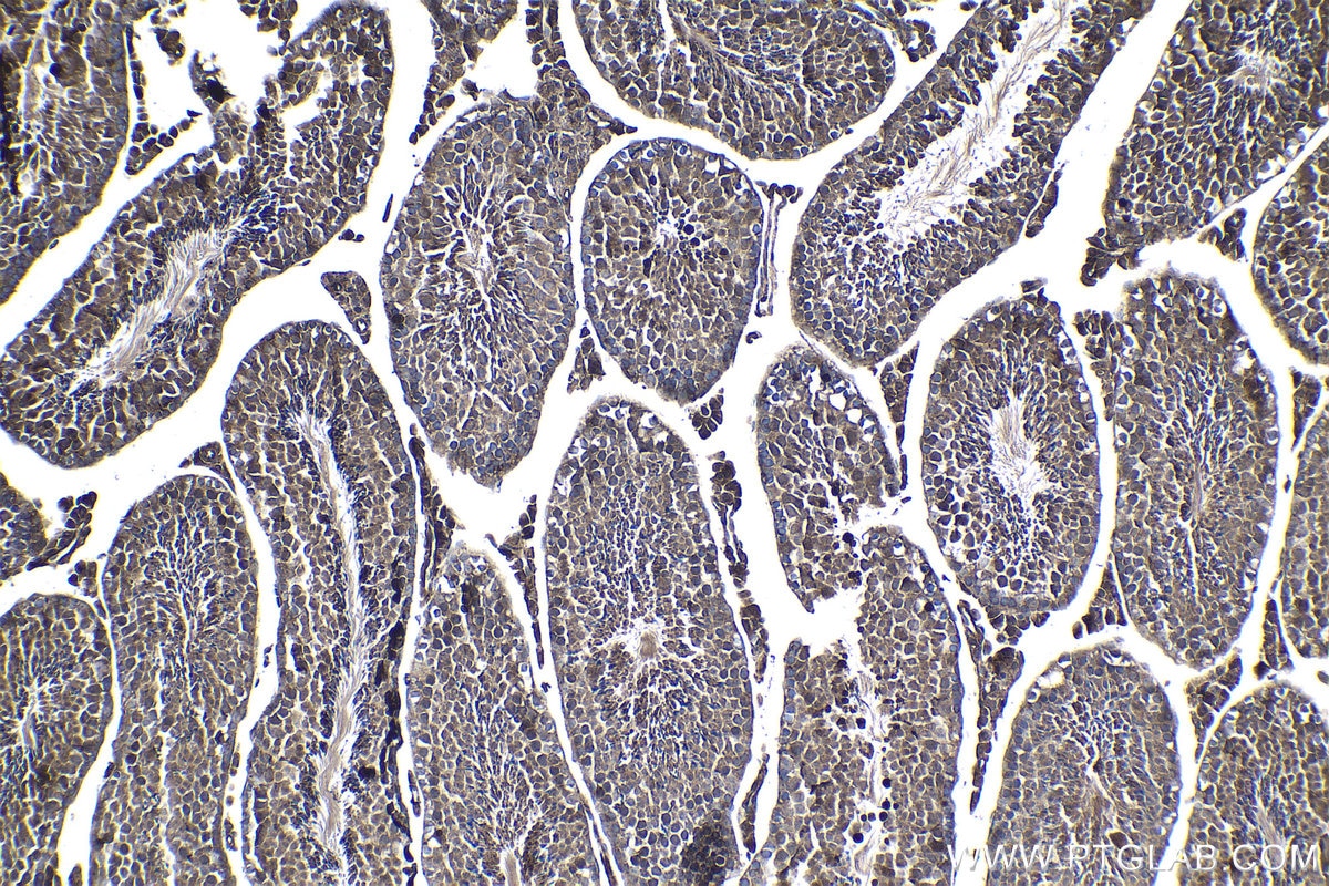 Immunohistochemical analysis of paraffin-embedded mouse testis tissue slide using KHC1051 (IGFBP7 IHC Kit).