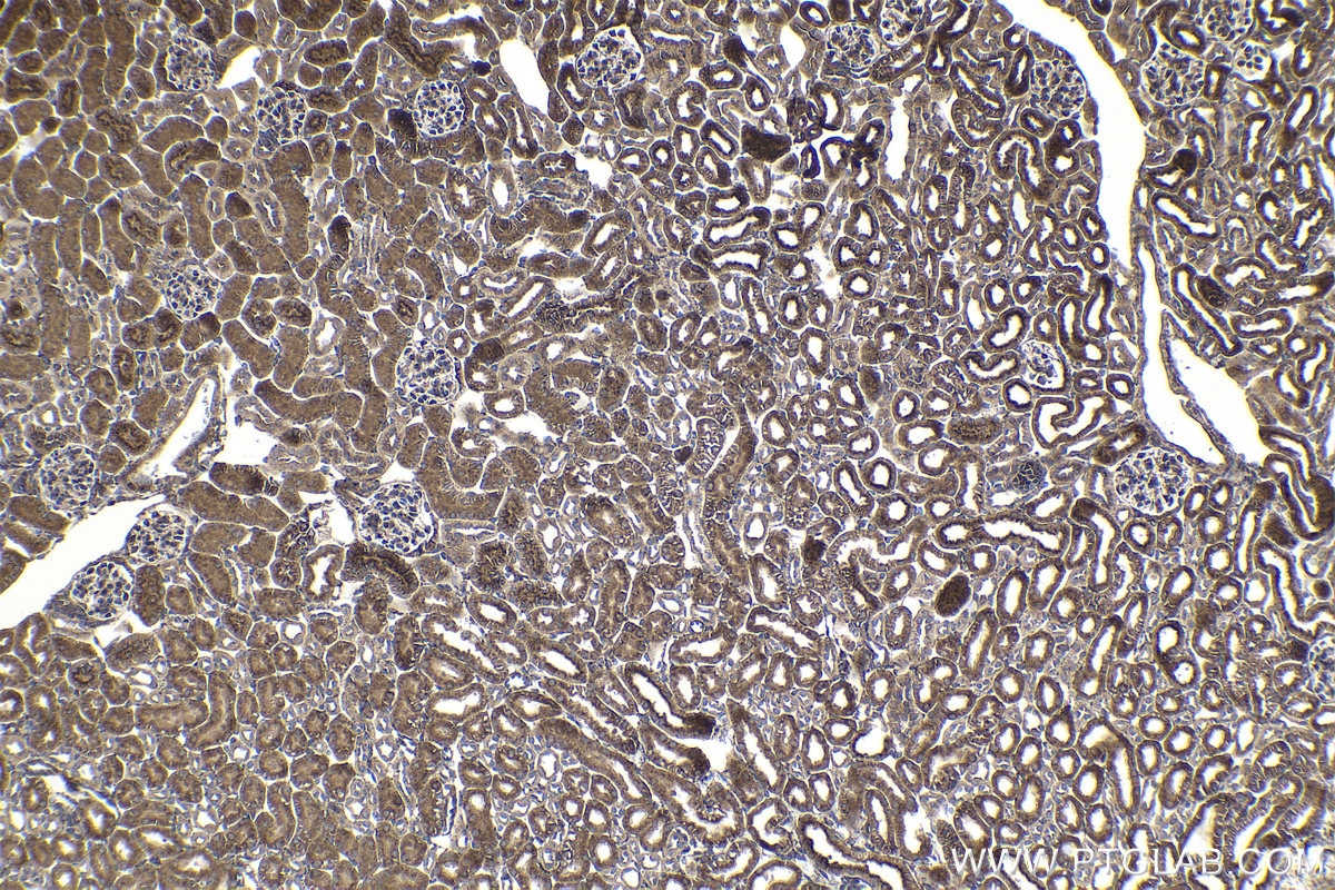 Immunohistochemical analysis of paraffin-embedded mouse kidney tissue slide using KHC1051 (IGFBP7 IHC Kit).