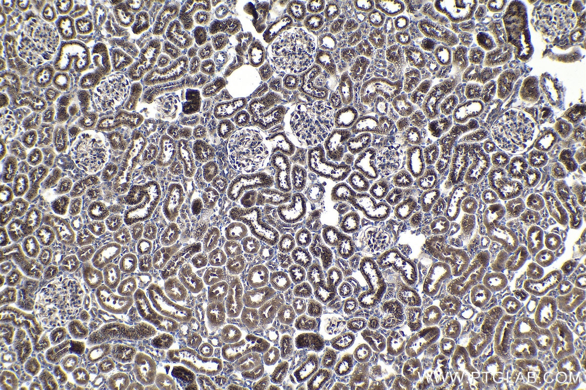 Immunohistochemical analysis of paraffin-embedded rat kidney tissue slide using KHC1051 (IGFBP7 IHC Kit).