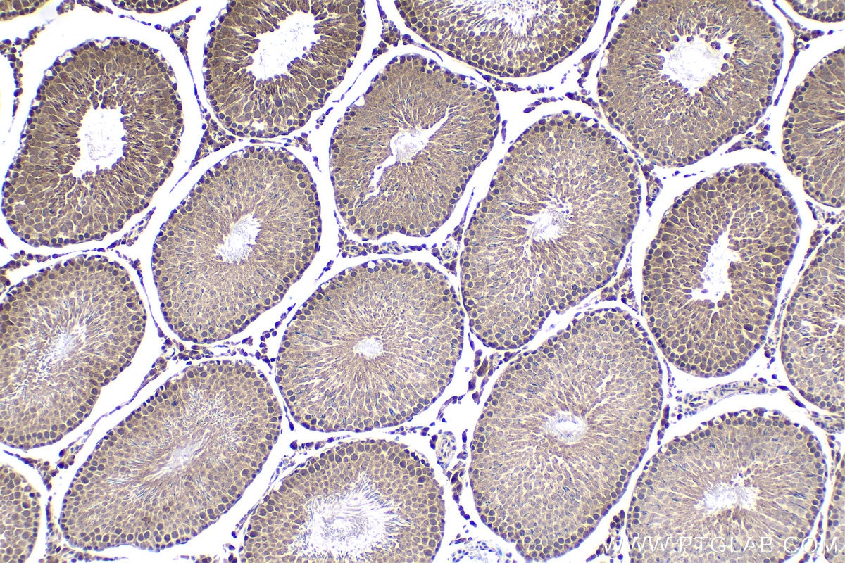 Immunohistochemical analysis of paraffin-embedded rat testis tissue slide using KHC1589 (IGHMBP2 IHC Kit).