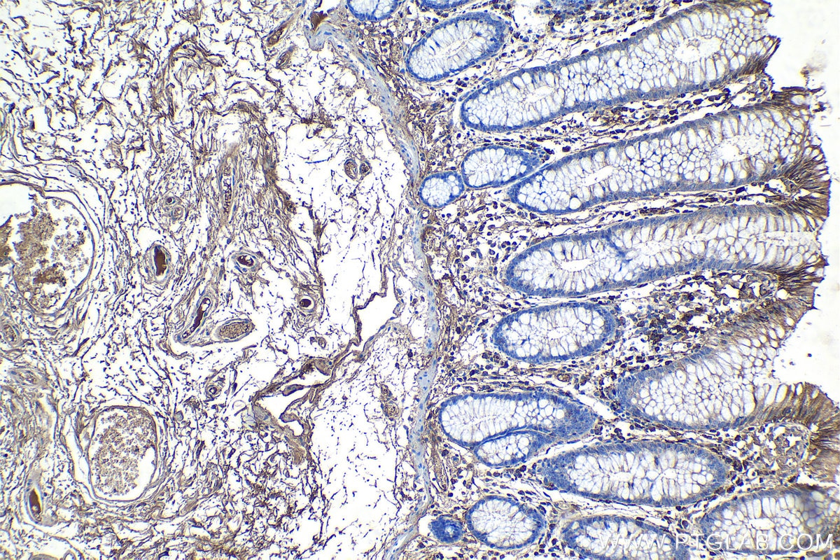 Immunohistochemical analysis of paraffin-embedded human colon tissue slide using KHC1194 (IGJ IHC Kit).