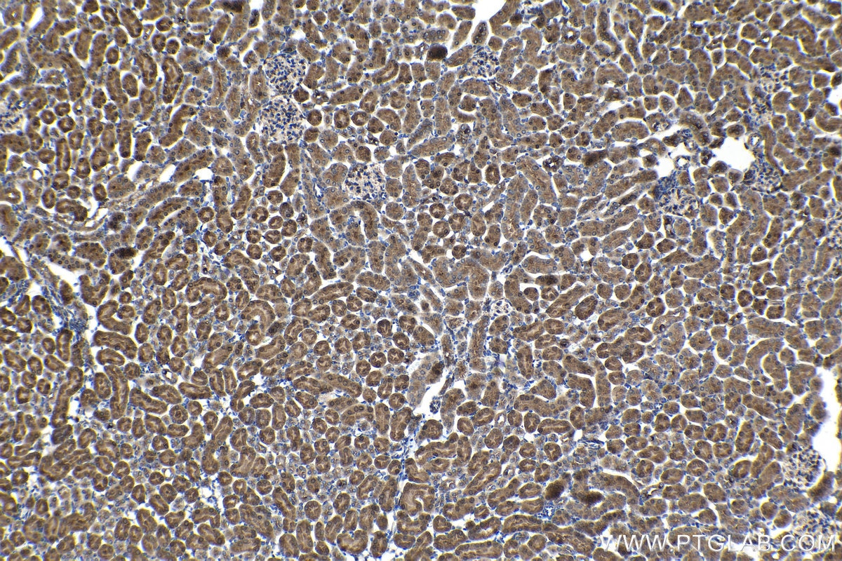 Immunohistochemical analysis of paraffin-embedded mouse kidney tissue slide using KHC1432 (IKBKB IHC Kit).