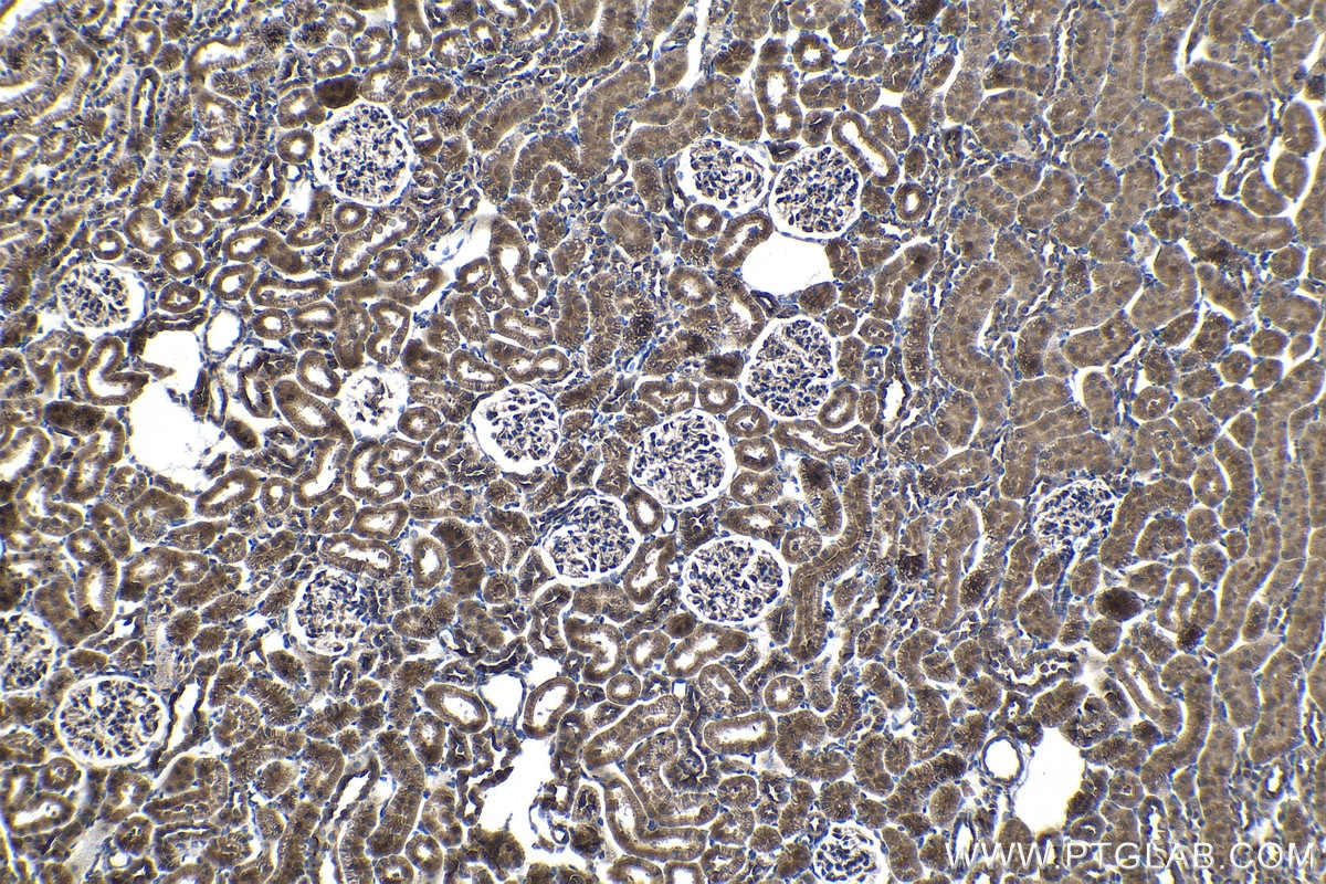 Immunohistochemical analysis of paraffin-embedded rat kidney tissue slide using KHC1432 (IKBKB IHC Kit).