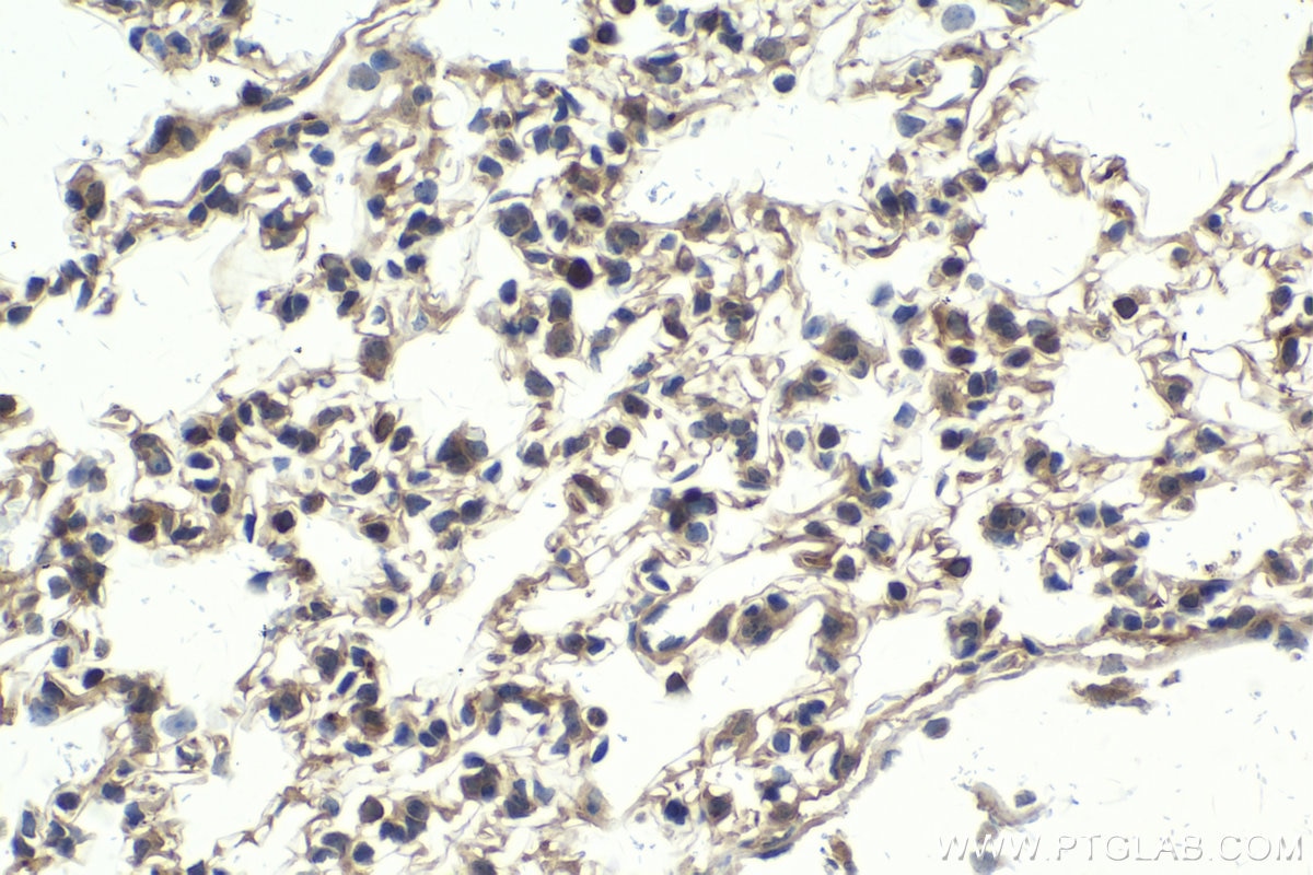 Immunohistochemical analysis of paraffin-embedded mouse lung tissue slide using KHC2081 (IKBKG IHC Kit).
