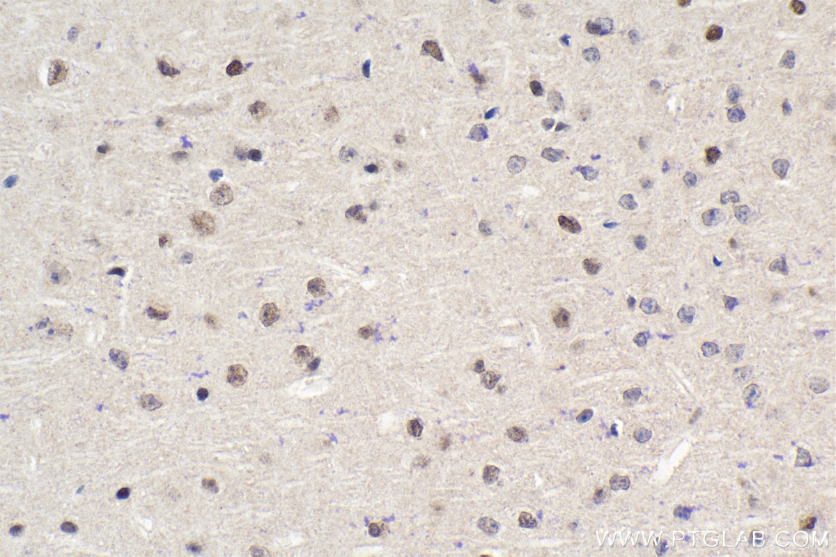 Immunohistochemical analysis of paraffin-embedded mouse brain tissue slide using KHC1934 (IKZF5 IHC Kit).