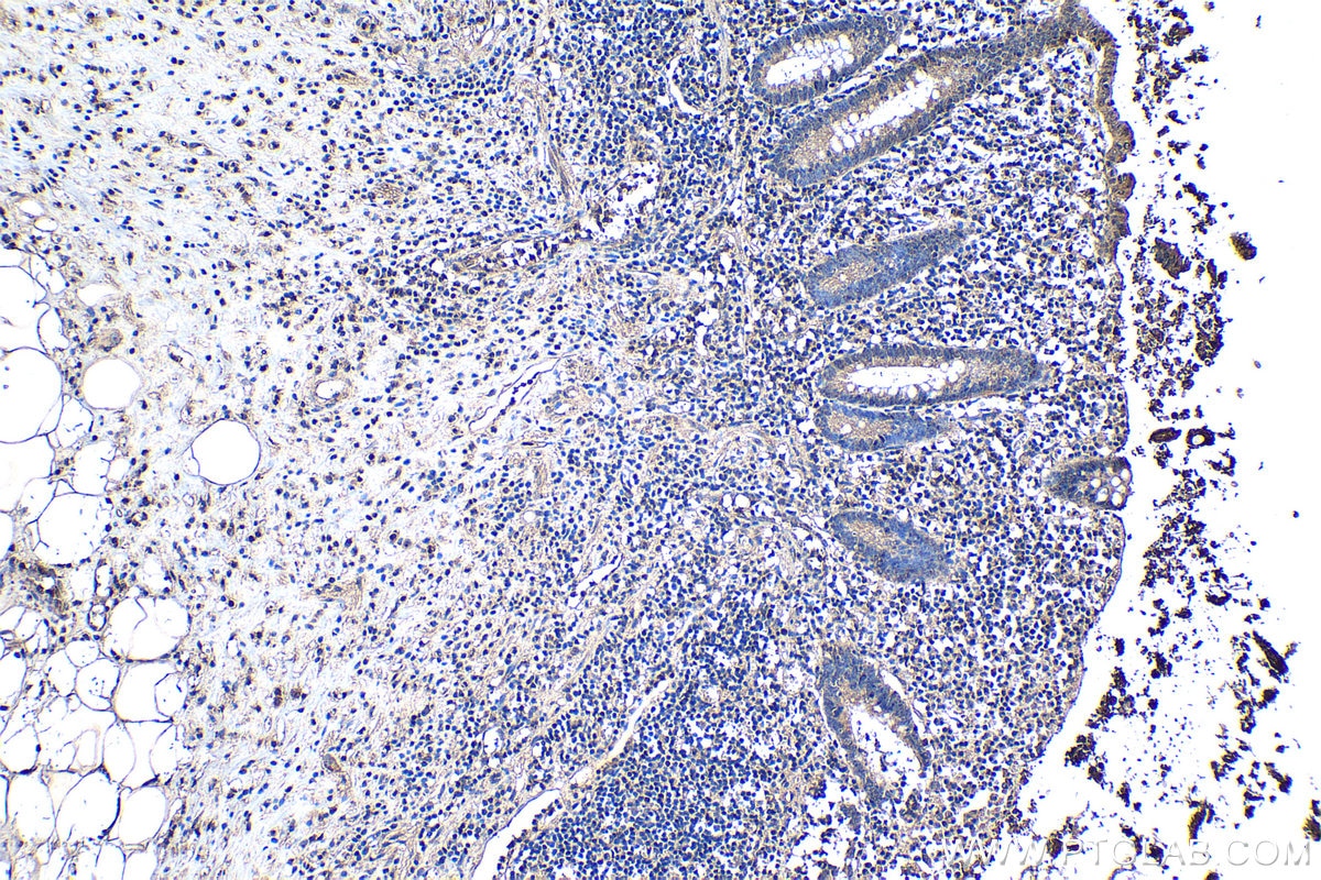Immunohistochemical analysis of paraffin-embedded human appendicitis tissue slide using KHC1253 (IL1A IHC Kit).