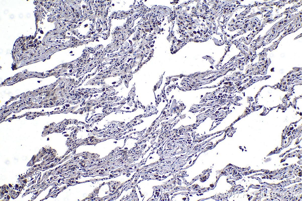 Immunohistochemical analysis of paraffin-embedded human lung tissue slide using KHC1253 (IL1A IHC Kit).