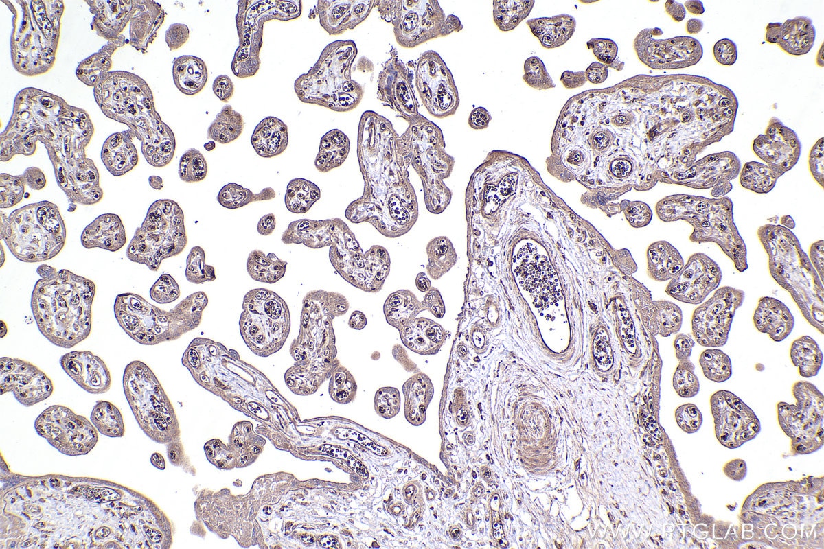 Immunohistochemical analysis of paraffin-embedded human placenta tissue slide using KHC2406 (IL1RL1/ST2 IHC Kit).