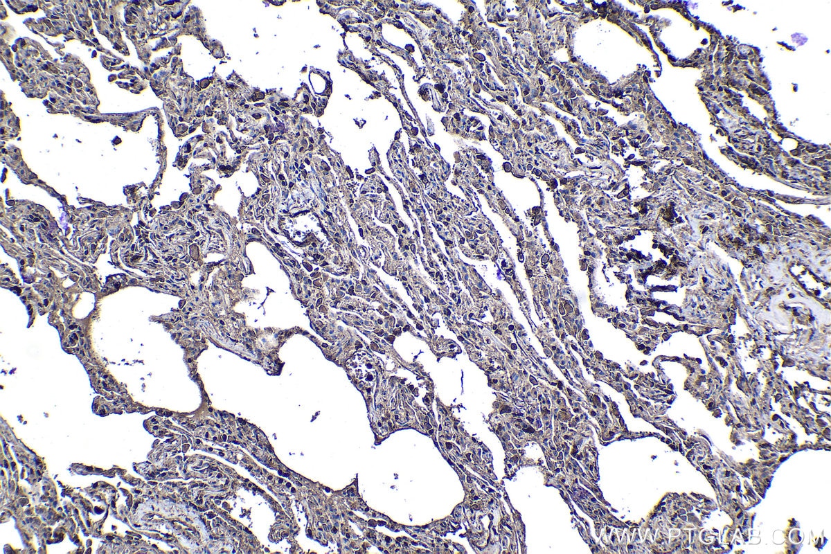 Immunohistochemical analysis of paraffin-embedded human lung tissue slide using KHC1135 (IL23A IHC Kit).
