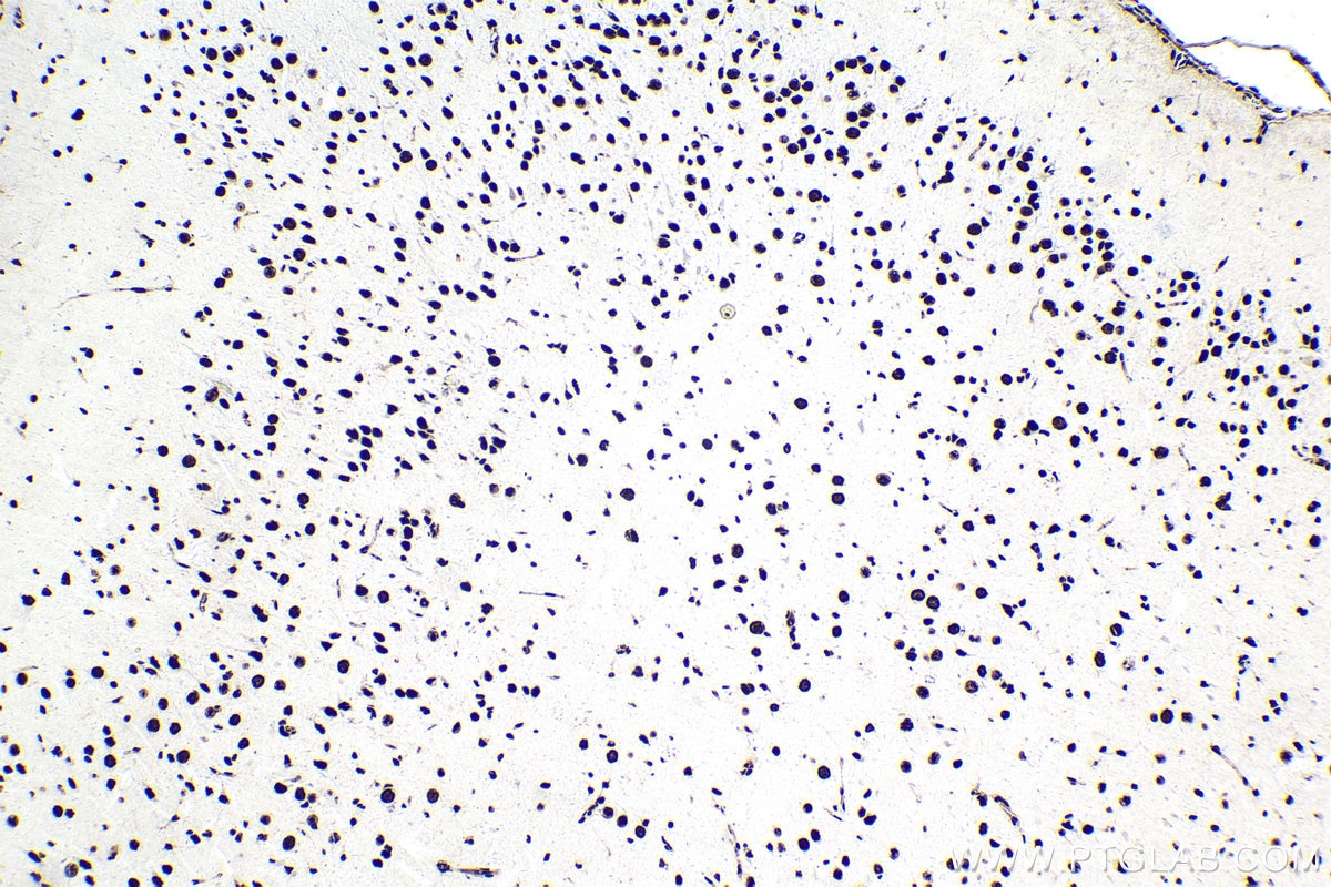 Immunohistochemical analysis of paraffin-embedded rat brain tissue slide using KHC1695 (ILF3 IHC Kit).