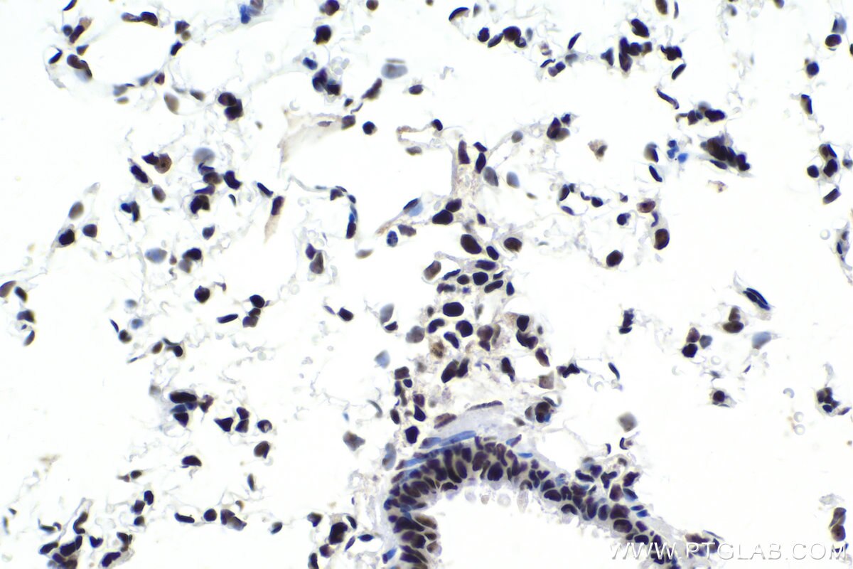 Immunohistochemical analysis of paraffin-embedded rat lung tissue slide using KHC1695 (ILF3 IHC Kit).