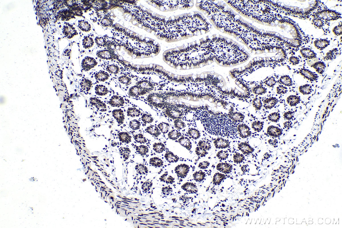 Immunohistochemical analysis of paraffin-embedded rat small intestine tissue slide using KHC1695 (ILF3 IHC Kit).