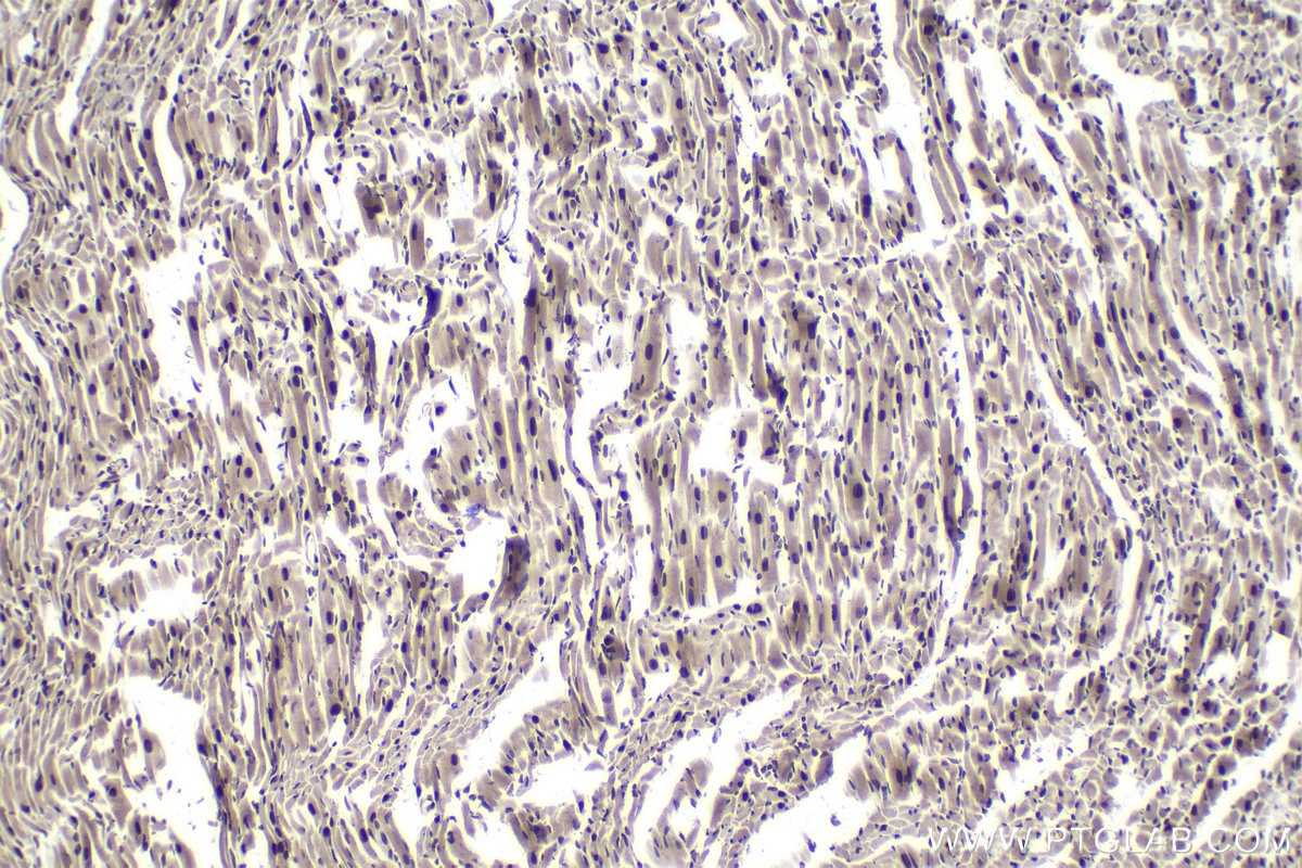 Immunohistochemical analysis of paraffin-embedded mouse heart tissue slide using KHC1022 (ILKAP IHC Kit).