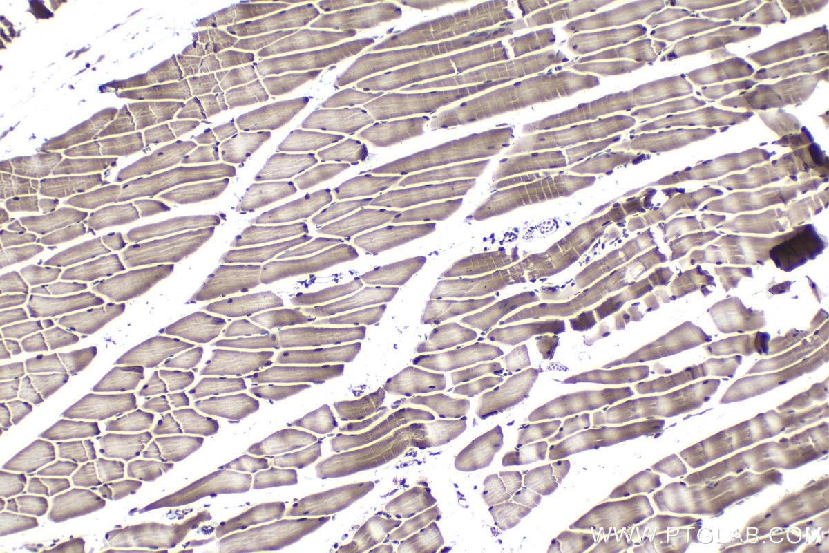 Immunohistochemical analysis of paraffin-embedded mouse skeletal muscle tissue slide using KHC1022 (ILKAP IHC Kit).
