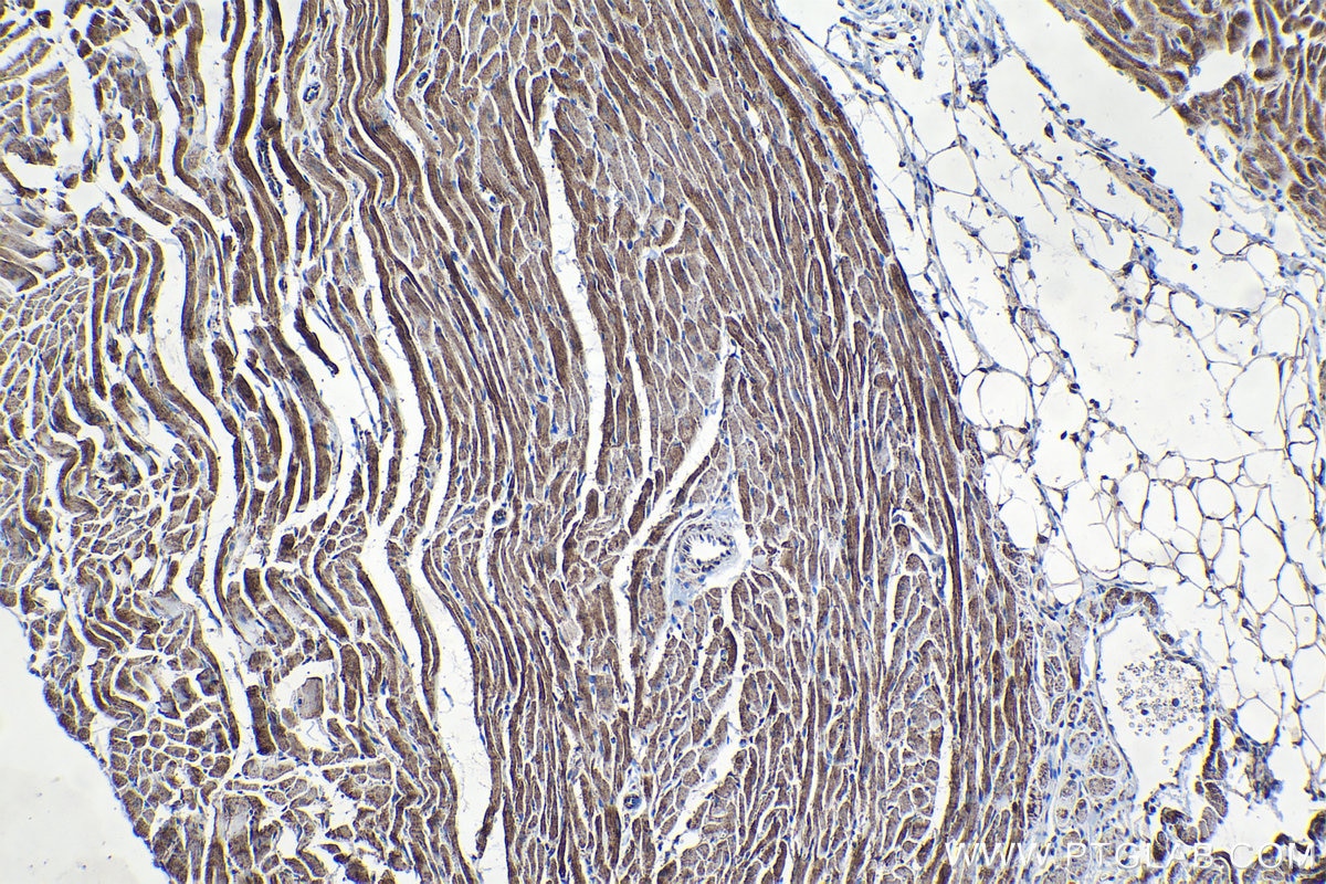 Immunohistochemical analysis of paraffin-embedded rat heart tissue slide using KHC1362 (IMMT IHC Kit).