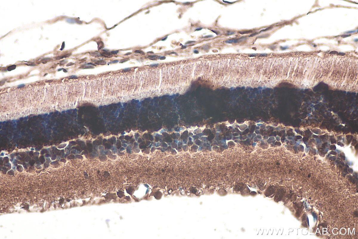 Immunohistochemical analysis of paraffin-embedded rat eye tissue slide using KHC0911 (IMPDH1 IHC Kit).