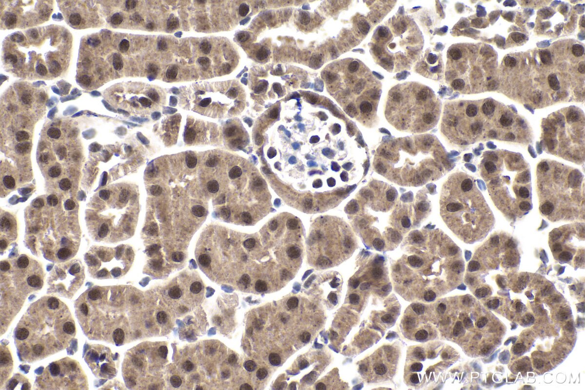 Immunohistochemical analysis of paraffin-embedded mouse kidney tissue slide using KHC1922 (ING2 IHC Kit).