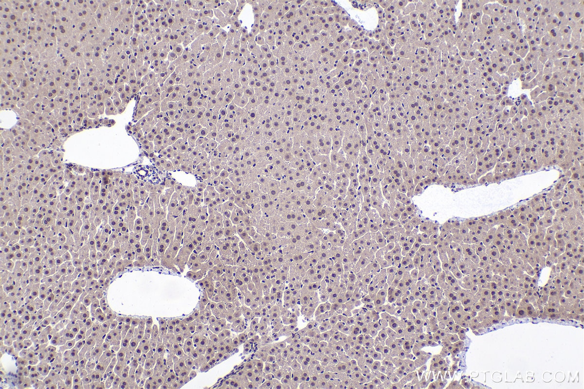 Immunohistochemical analysis of paraffin-embedded mouse liver tissue slide using KHC2005 (ING4 IHC Kit).
