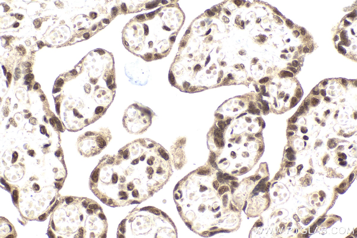 Immunohistochemical analysis of paraffin-embedded human placenta tissue slide using KHC2005 (ING4 IHC Kit).