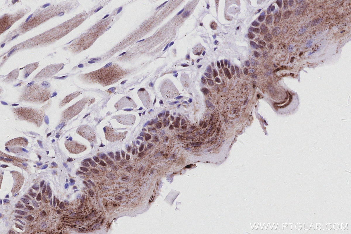 Immunohistochemical analysis of paraffin-embedded mouse tongue tissue slide using KHC3035 (INO80 IHC Kit). Immunohistochemical analysis of paraffin-embedded mouse tongue tissue slide using KHC3035 (INO80 IHC Kit).