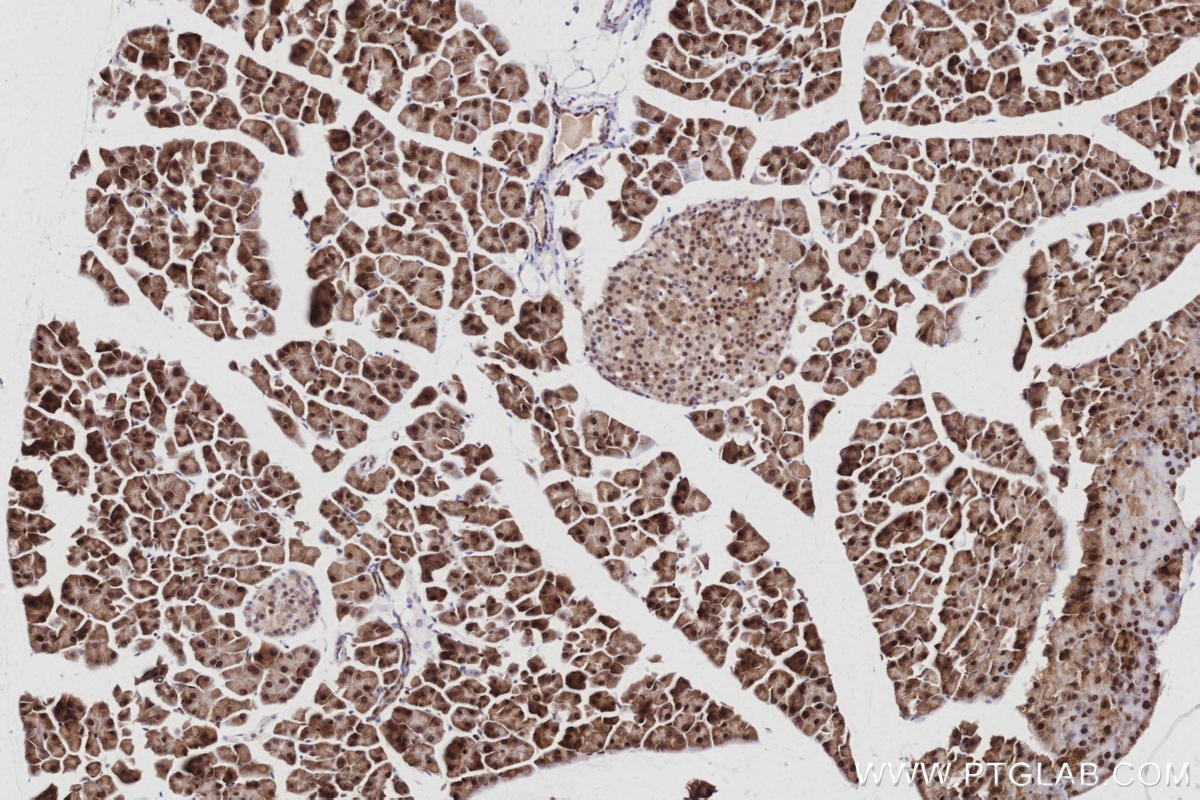 Immunohistochemical analysis of paraffin-embedded mouse pancreas tissue slide using KHC3035 (INO80 IHC Kit). Immunohistochemical analysis of paraffin-embedded mouse pancreas tissue slide using KHC3035 (INO80 IHC Kit).