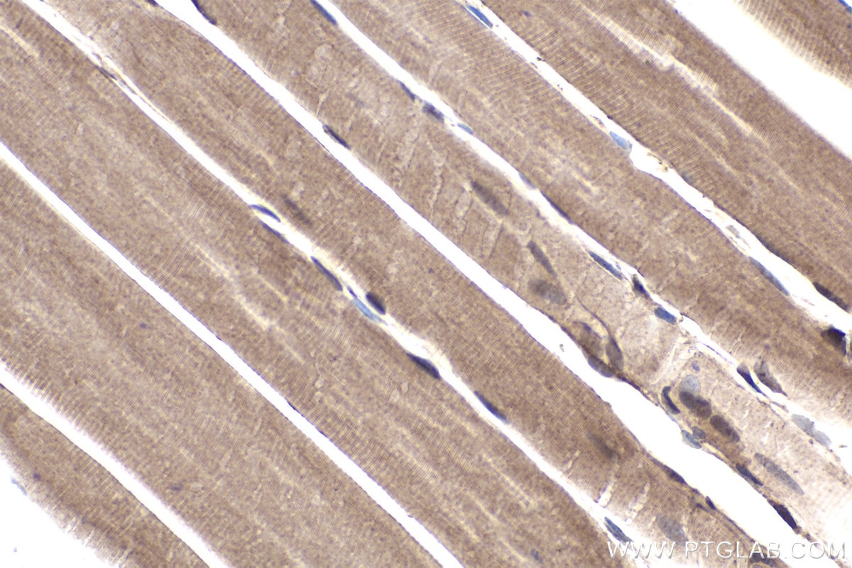 Immunohistochemical analysis of paraffin-embedded rat skeletal muscle tissue slide using KHC1902 (INPP5K IHC Kit).
