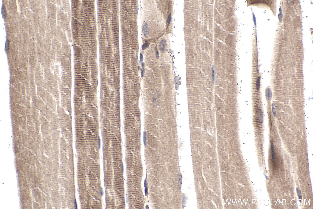Immunohistochemical analysis of paraffin-embedded mouse skeletal muscle tissue slide using KHC1902 (INPP5K IHC Kit).