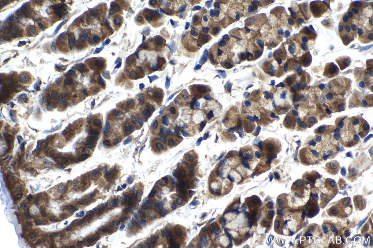 Immunohistochemical analysis of paraffin-embedded rat stomach tissue slide using KHC1444 (INPPL1 IHC Kit).