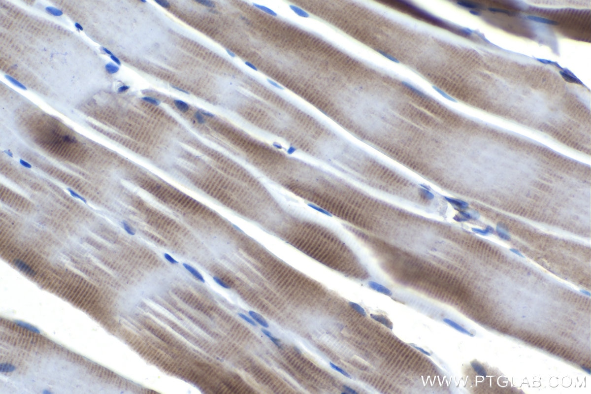 Immunohistochemical analysis of paraffin-embedded rat skeletal muscle tissue slide using KHC1444 (INPPL1 IHC Kit).