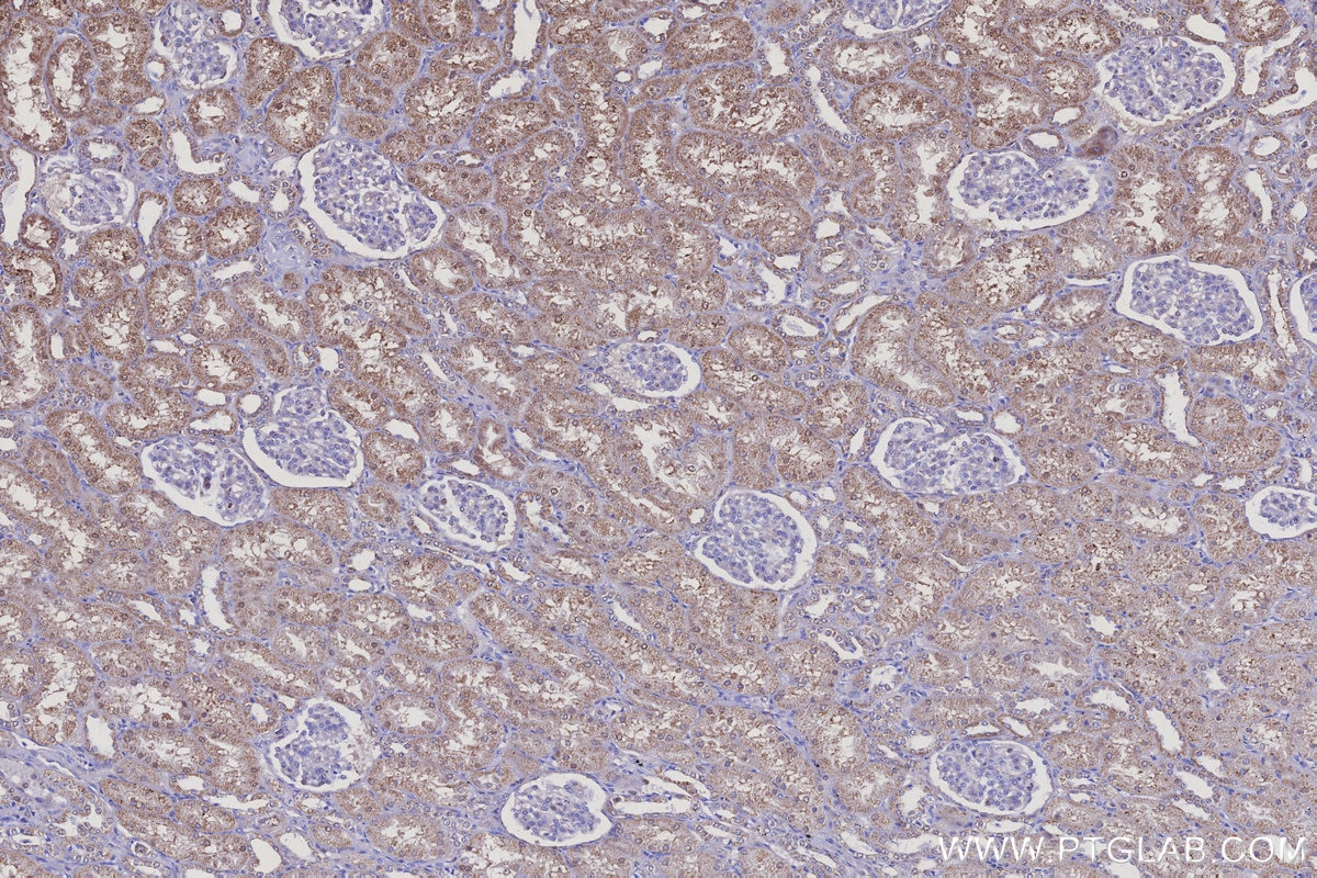 Immunohistochemical analysis of paraffin-embedded human kidney tissue slide using KHC3111 (INSM2 IHC Kit). Immunohistochemical analysis of paraffin-embedded human kidney tissue slide using KHC3111 (INSM2 IHC Kit).