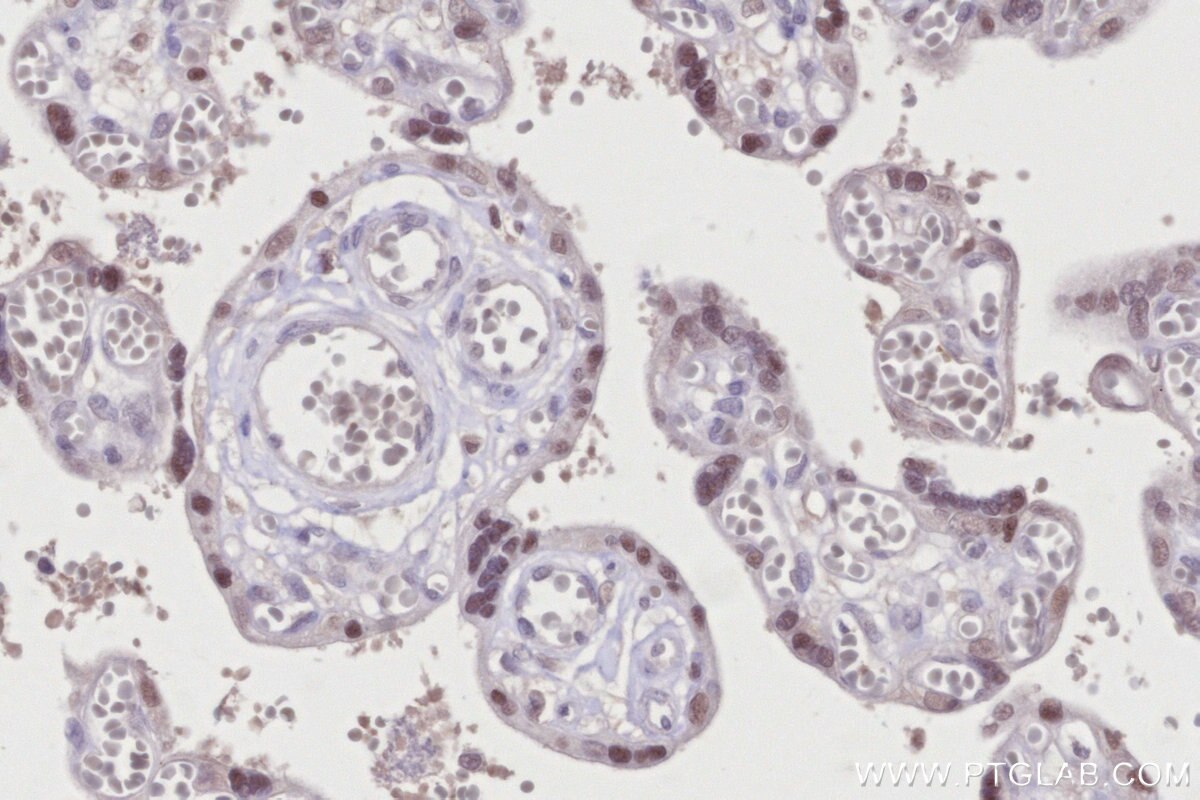 Immunohistochemical analysis of paraffin-embedded human placenta tissue slide using KHC2698 (IPMK IHC Kit).