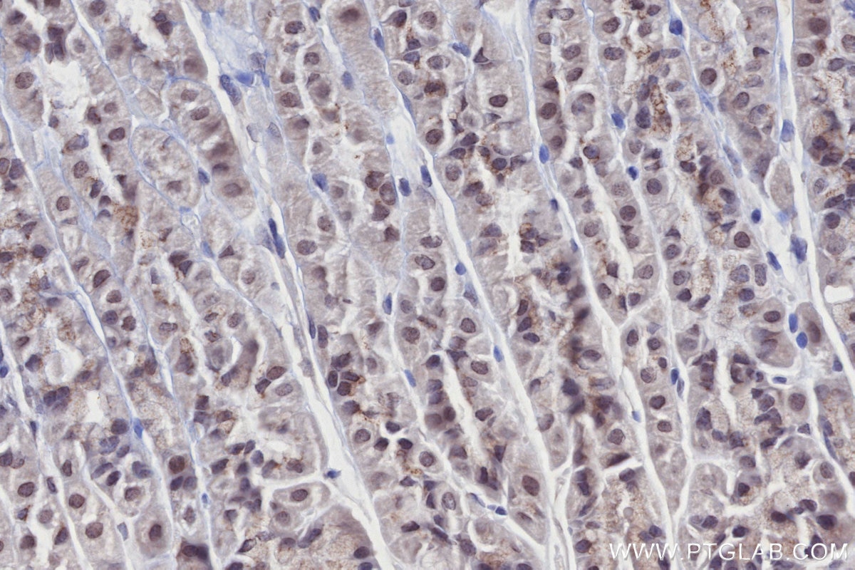 Immunohistochemical analysis of paraffin-embedded mouse stomach tissue slide using KHC2698 (IPMK IHC Kit).