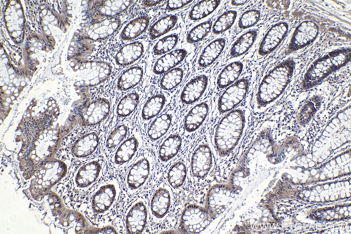 Immunohistochemical analysis of paraffin-embedded human colon tissue slide using KHC1248 (IPO7 IHC Kit).