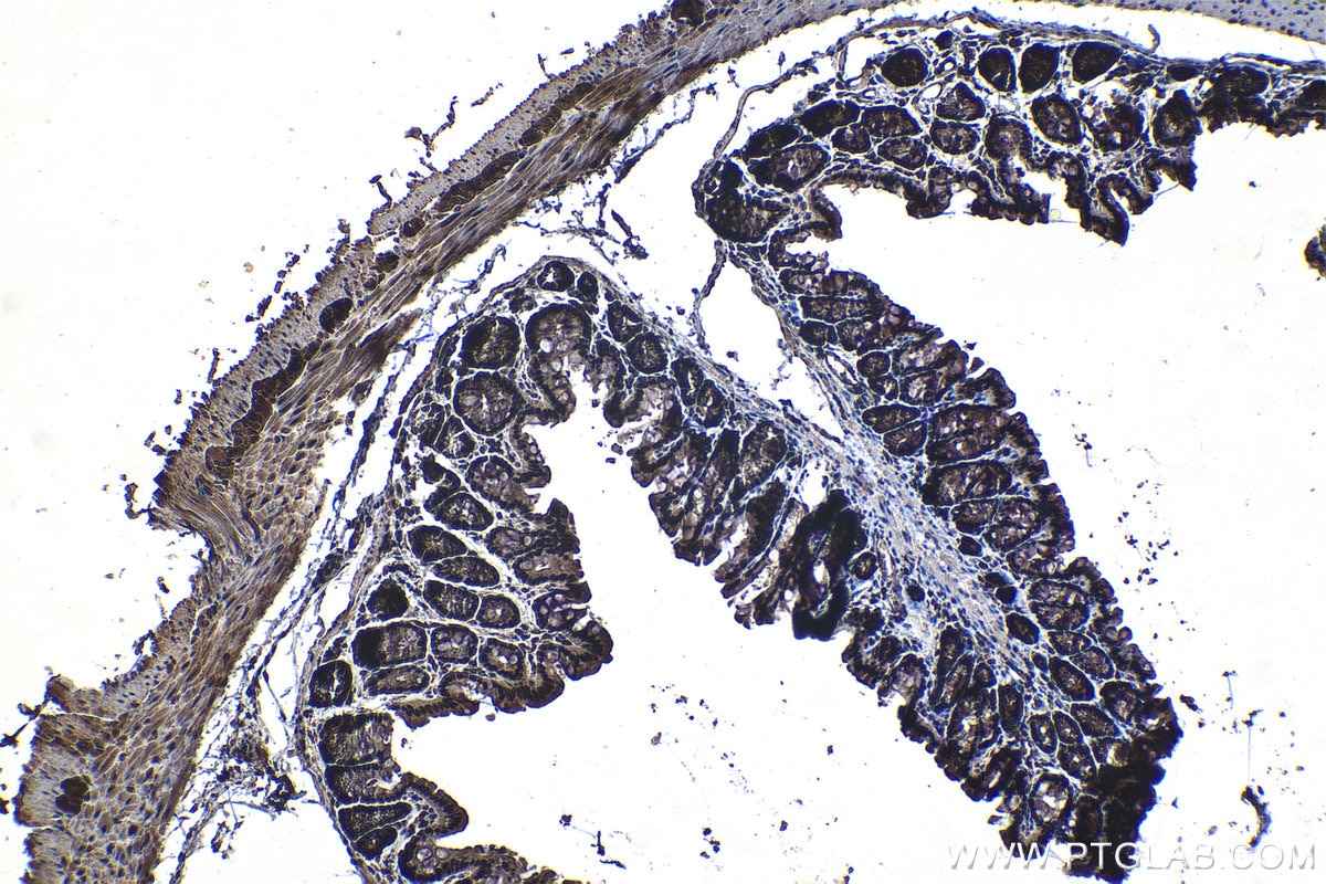 Immunohistochemical analysis of paraffin-embedded mouse colon tissue slide using KHC1248 (IPO7 IHC Kit).