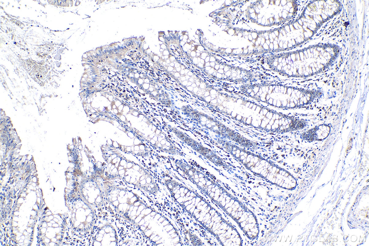 Immunohistochemical analysis of paraffin-embedded human colon tissue slide using KHC1136 (IRAK3 IHC Kit).