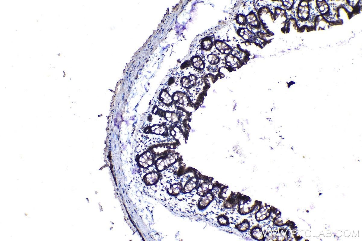 Immunohistochemical analysis of paraffin-embedded rat colon tissue slide using KHC1136 (IRAK3 IHC Kit).