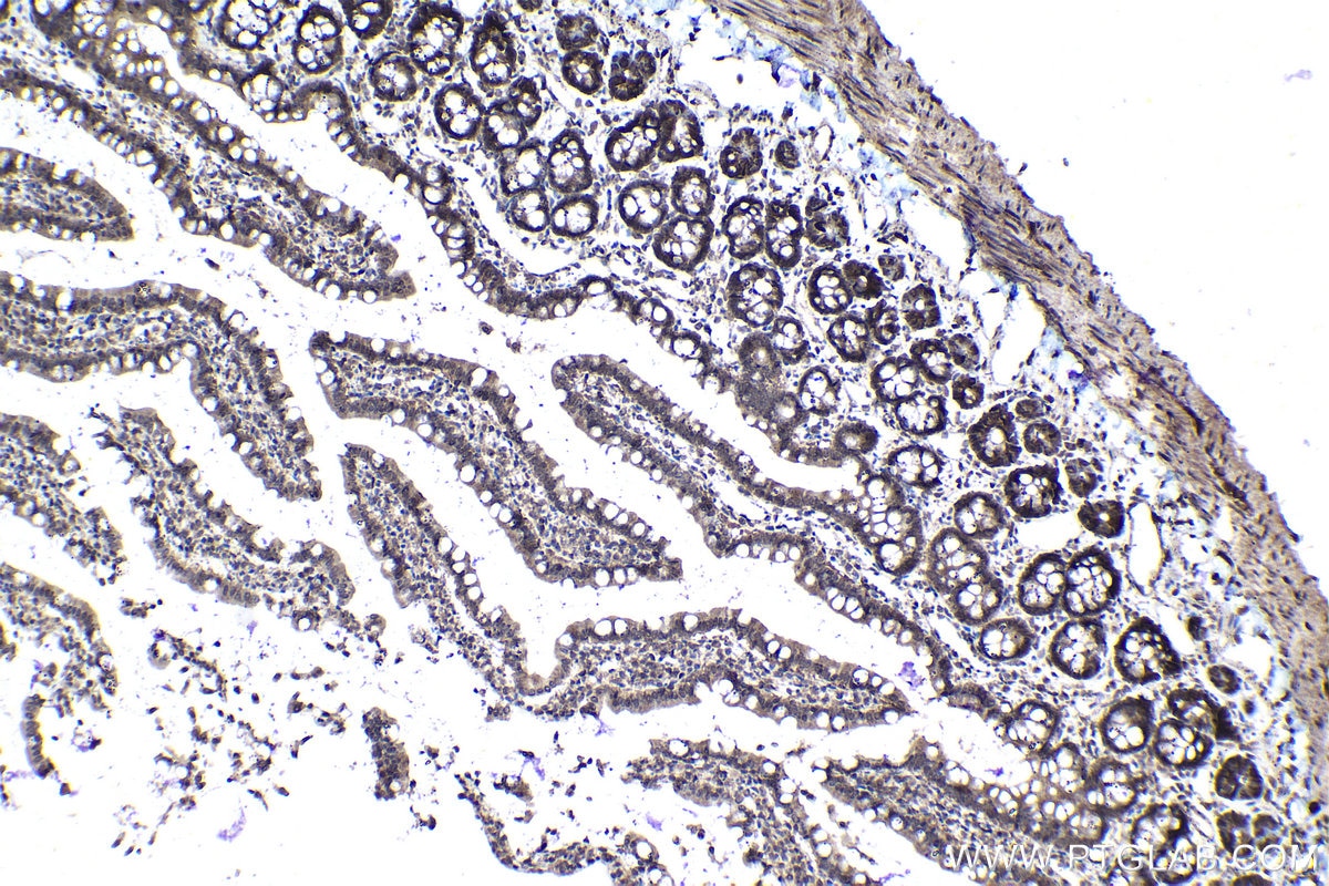Immunohistochemical analysis of paraffin-embedded rat small intestine tissue slide using KHC1136 (IRAK3 IHC Kit).