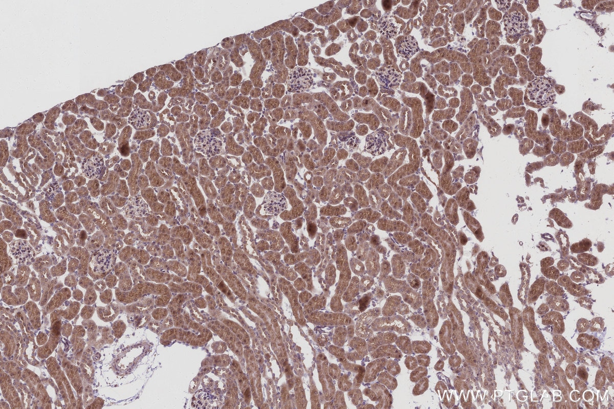 Immunohistochemical analysis of paraffin-embedded mouse kidney tissue slide using KHC2967 (IRAK4 IHC Kit).