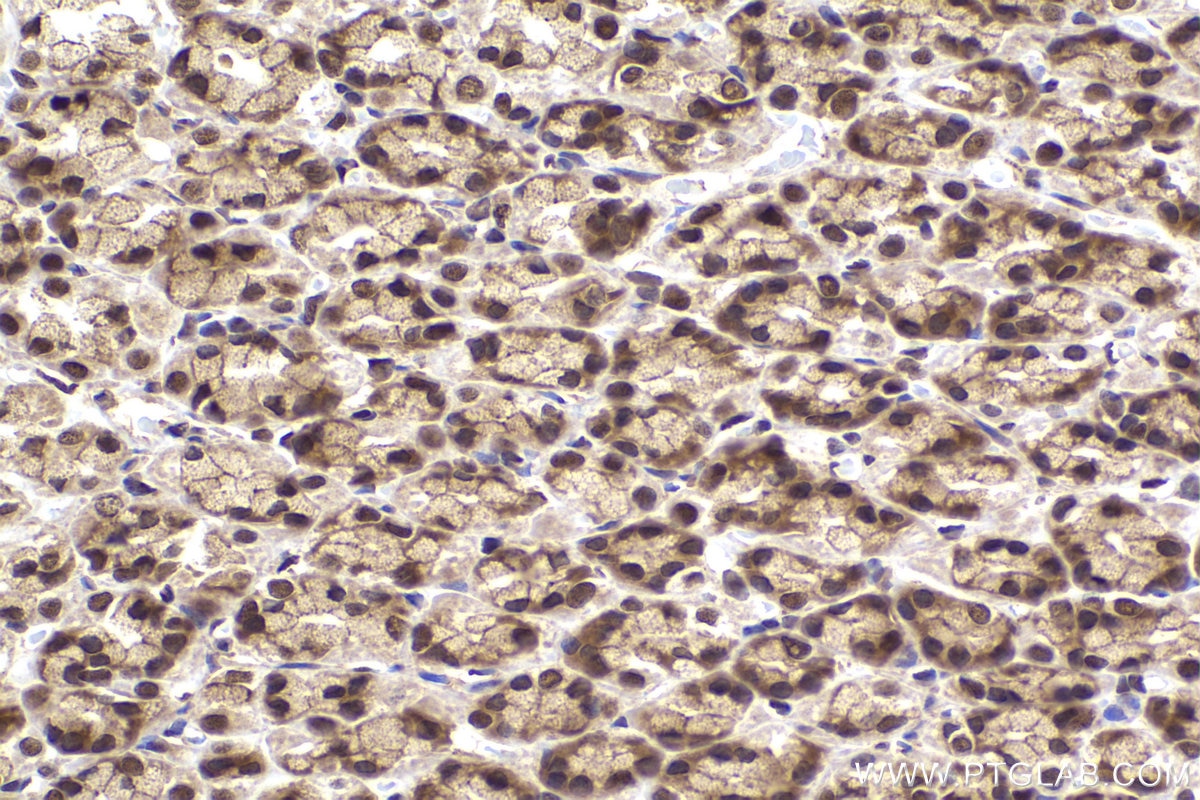 Immunohistochemical analysis of paraffin-embedded rat stomach tissue slide using KHC2176 (IRF1 IHC Kit).