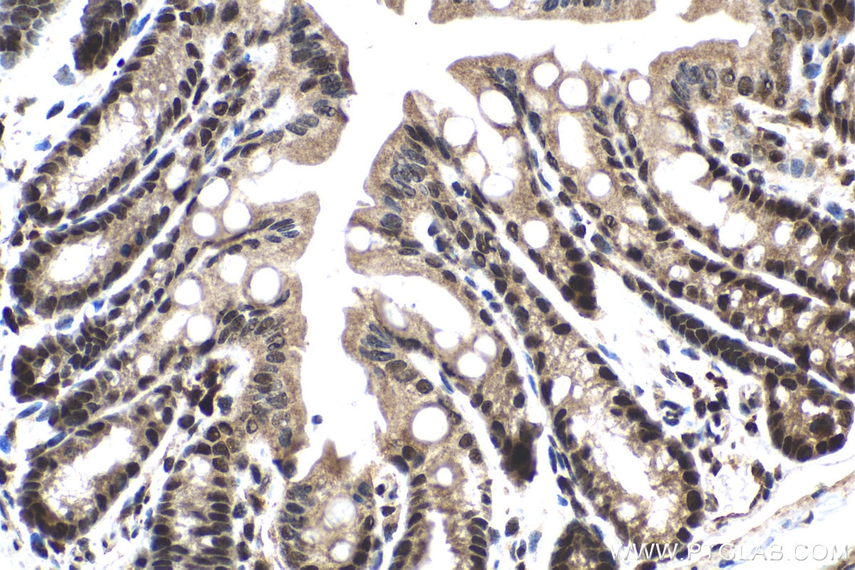 Immunohistochemical analysis of paraffin-embedded mouse colon tissue slide using KHC1531 (IRF2 IHC Kit).