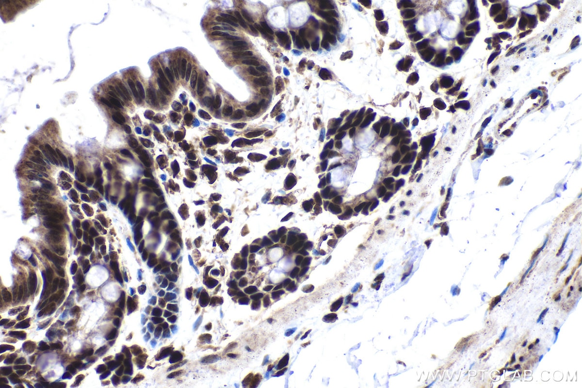 Immunohistochemical analysis of paraffin-embedded rat colon tissue slide using KHC1531 (IRF2 IHC Kit).