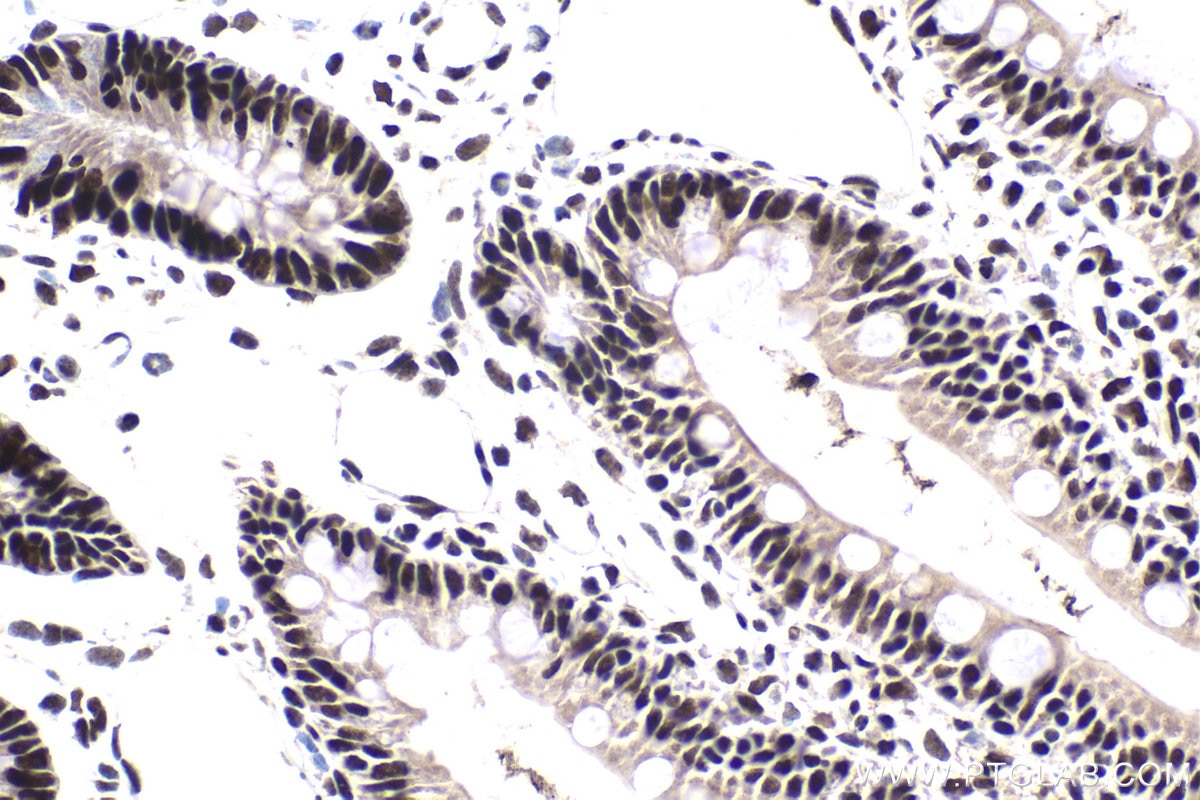 Immunohistochemical analysis of paraffin-embedded rat small intestine tissue slide using KHC1813 (IRF2BP1 IHC Kit).