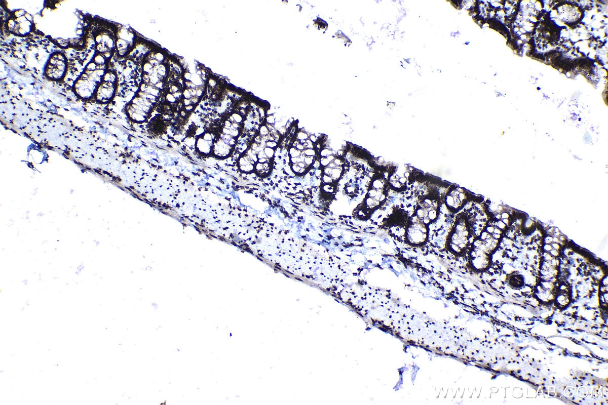 Immunohistochemical analysis of paraffin-embedded rat colon tissue slide using KHC1137 (IRF3 IHC Kit).