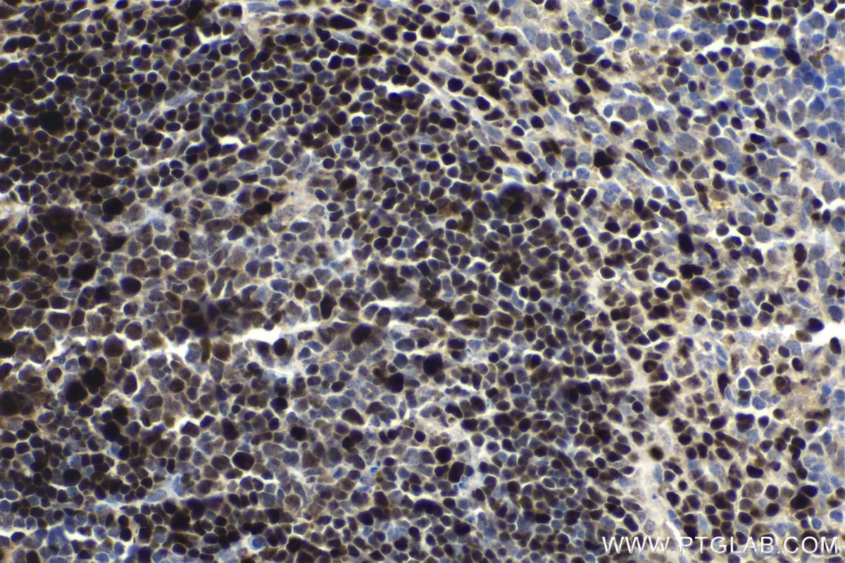 Immunohistochemical analysis of paraffin-embedded mouse spleen tissue slide using KHC1749 (IRF4 IHC Kit).