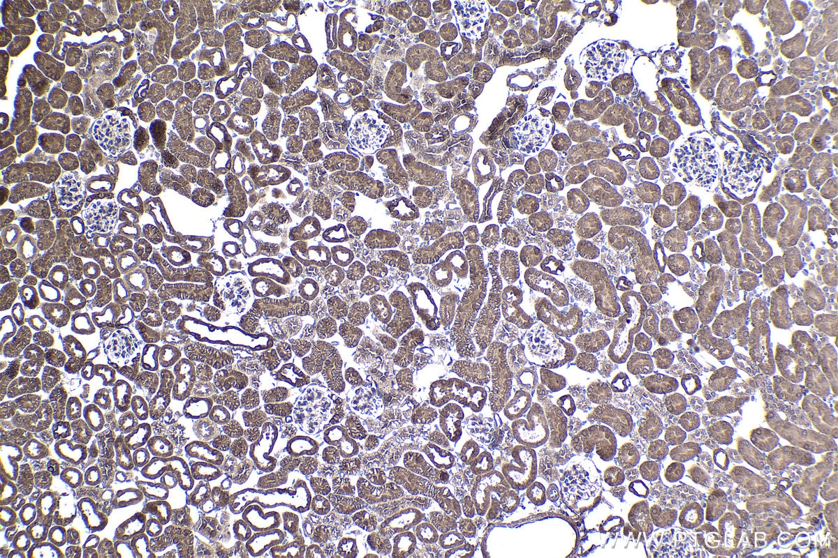 Immunohistochemical analysis of paraffin-embedded mouse kidney tissue slide using KHC1431 (IRF6 IHC Kit).