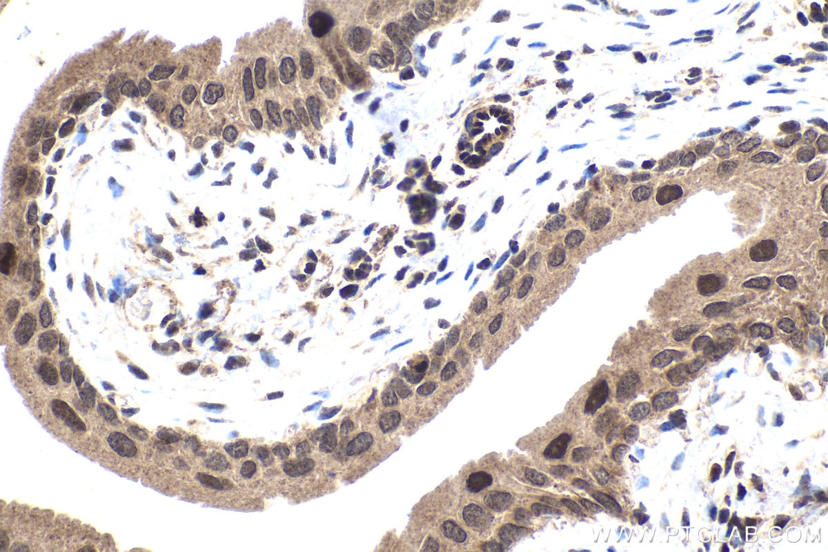 Immunohistochemical analysis of paraffin-embedded mouse bladder tissue slide using KHC1660 (IRF9 IHC Kit).